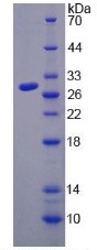SDS-PAGE TLR4-7618H.jpg